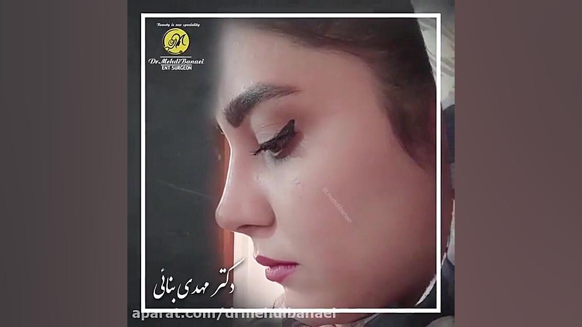 جراحی زیبایی بینی
