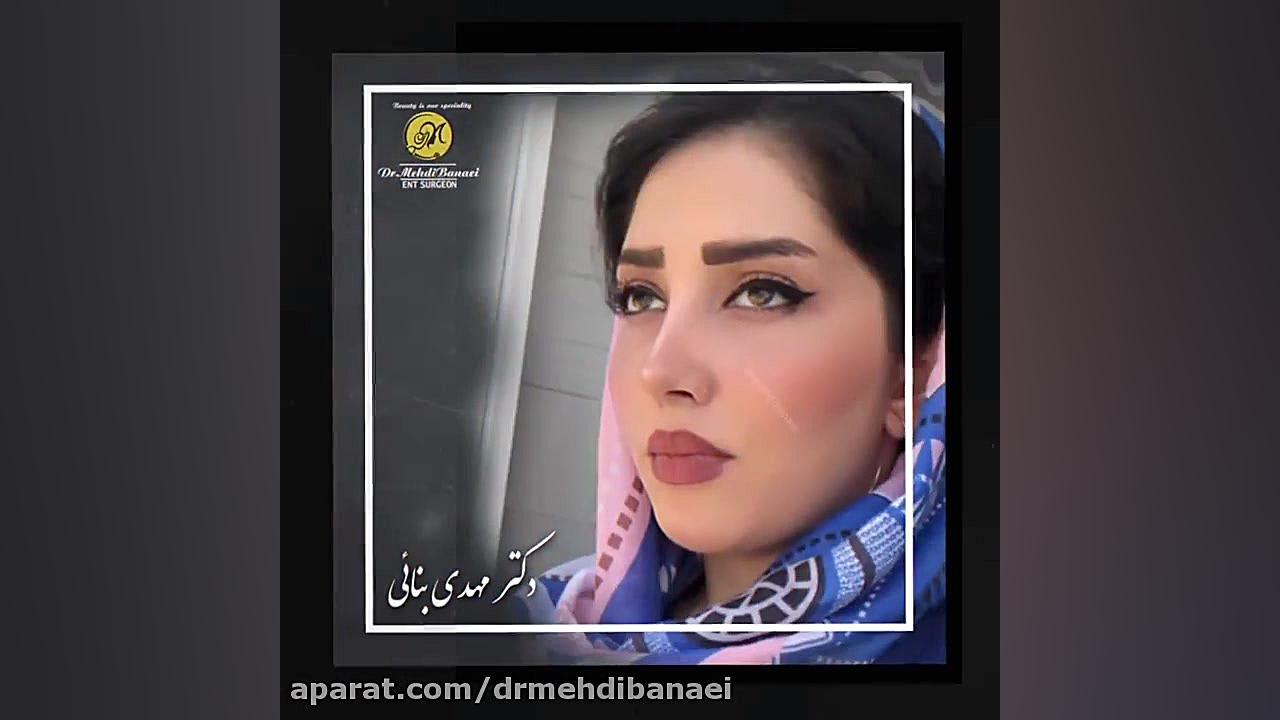 عمل زیبایی بینی