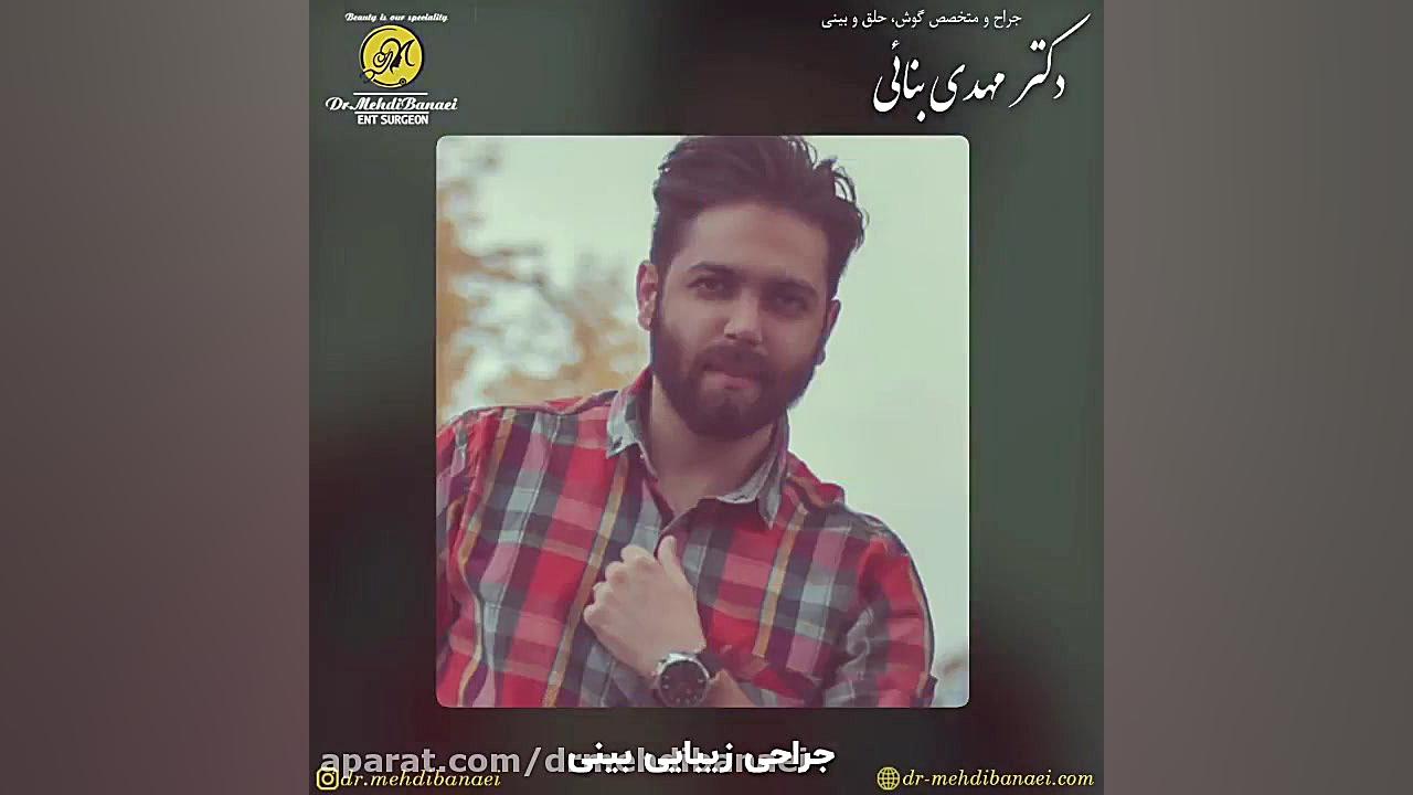 جراحی زیبایی بینی مردانه