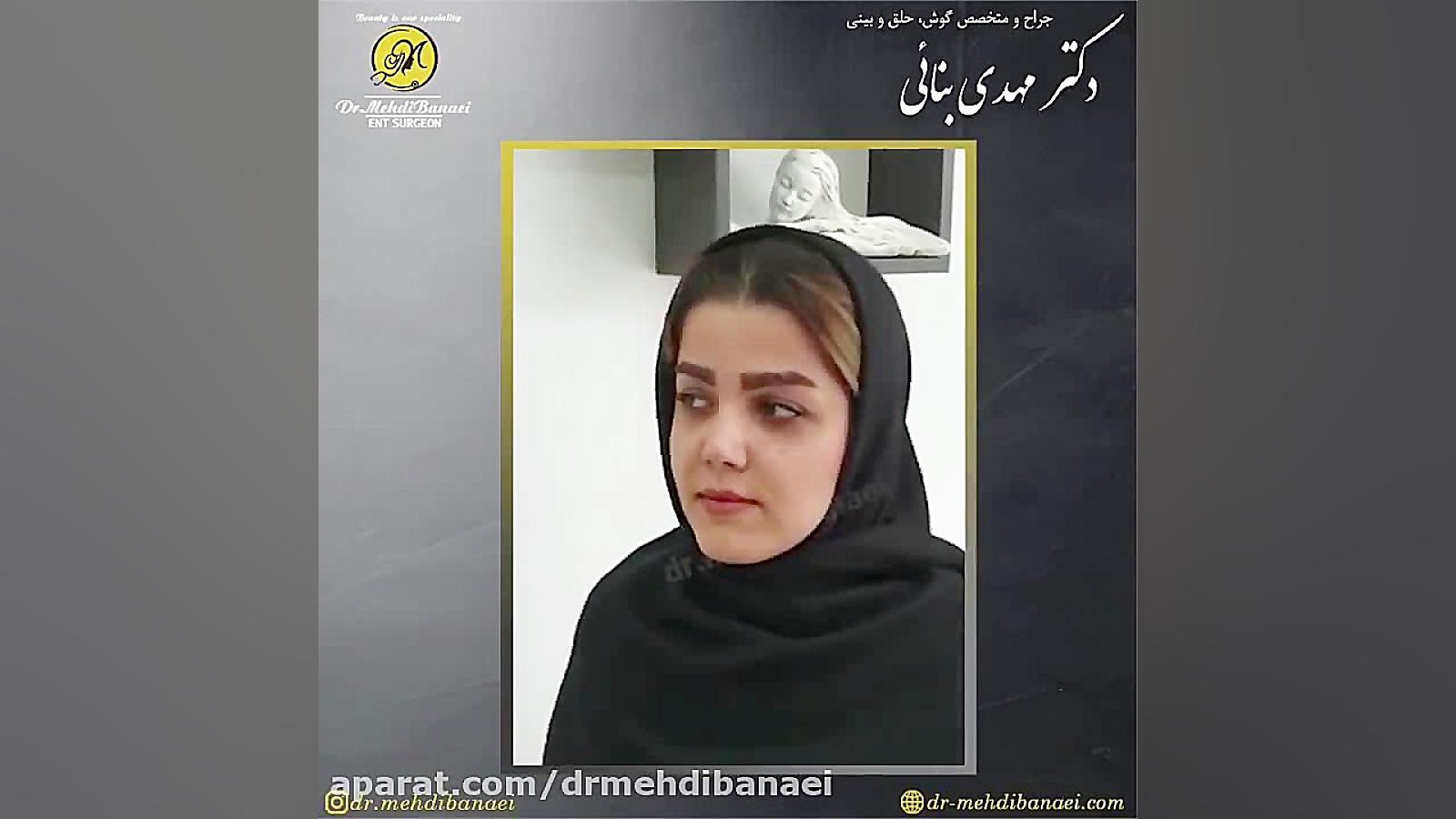 جراحی زیبایی بینی