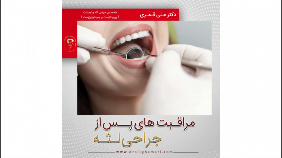 فیلم توضیحات مراقبت های پس از جراحی لثه دکتر علی قمری - متخصص جراحی لثه و ایمپلنت