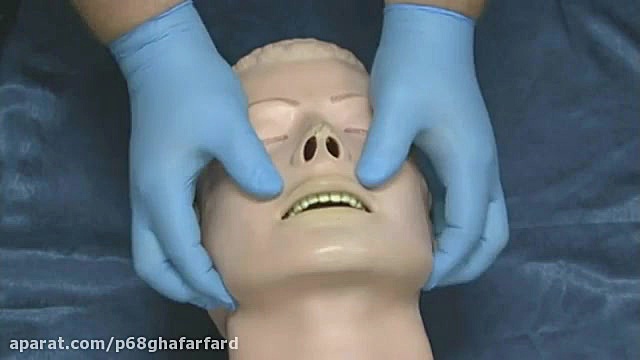 مانور Jaw thrust دندان شیری