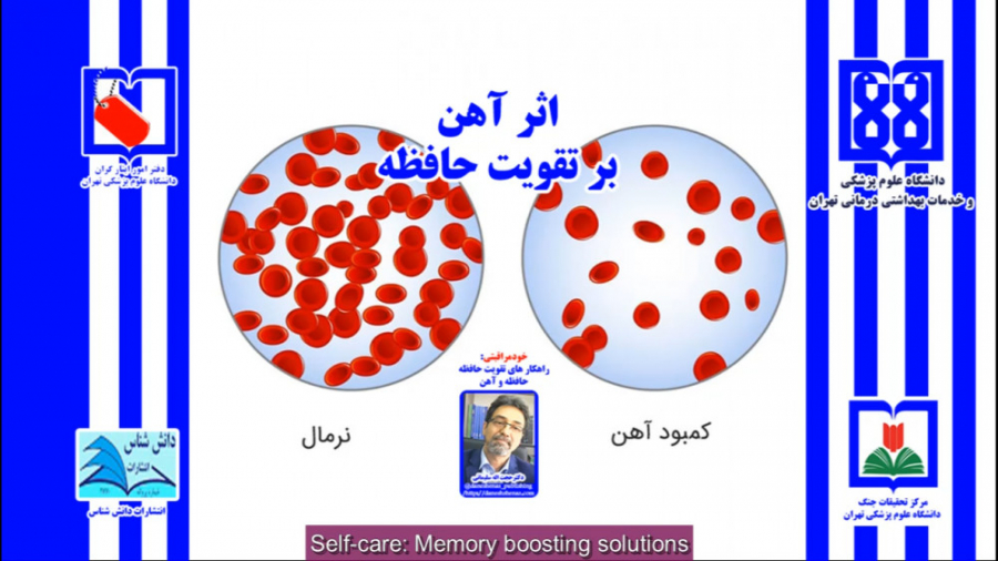 36) اثر آهن در تقویت حافظه لمینت