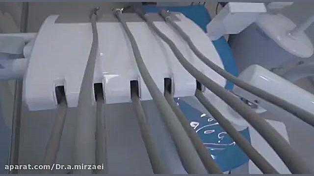 دندانپزشکی دکتر علی میرزائی ترمیم زیبایی دندان