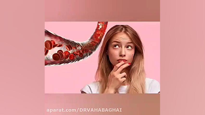 علائم و نشانه های تخمدان پلی کیستیک میکرونیدلینگ