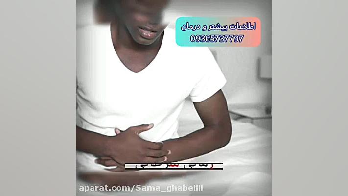 داروی زخم معده و مشکلات گوارشی عمل زیبایی