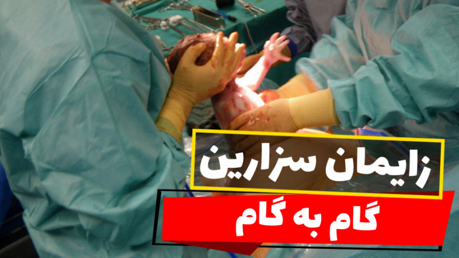 زایمان سزارین گام به گام فرزانه آقایانی | کارشناس مامایی | مشاور شیردهی