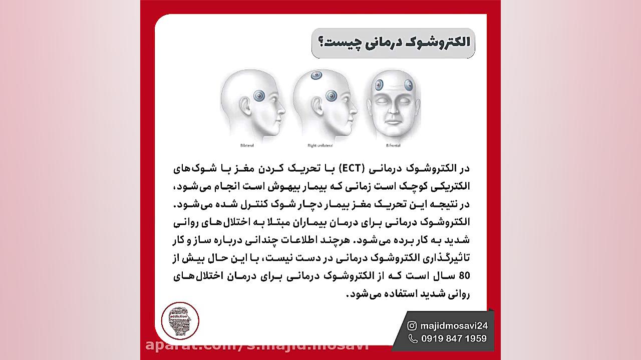 شوک درمانی در ترک اعتیاد ویدیو قندی