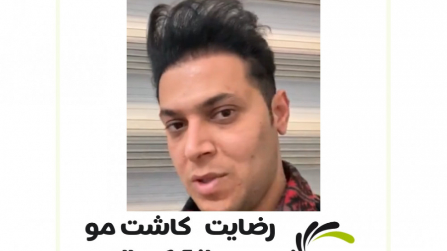 کاشت مو به روش بدون جراحی دستگاه Cell Sorter