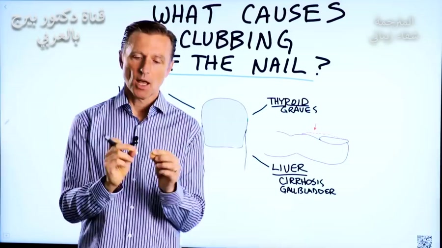 انگلیسی با زیرنویس عربی - تشخیص بیماری قلب و کبد از طریق نگاه به ناخن ها