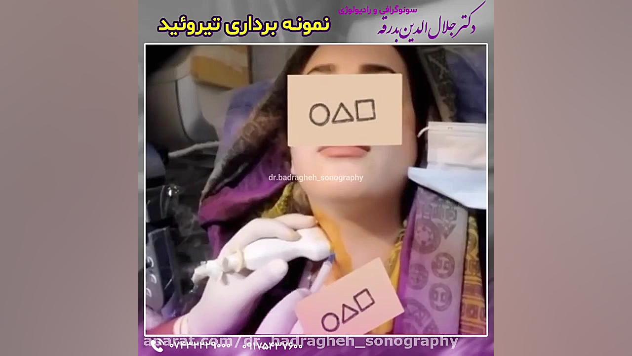 نمونه برداری تیروئید دکتر جلال الدین بدرقه