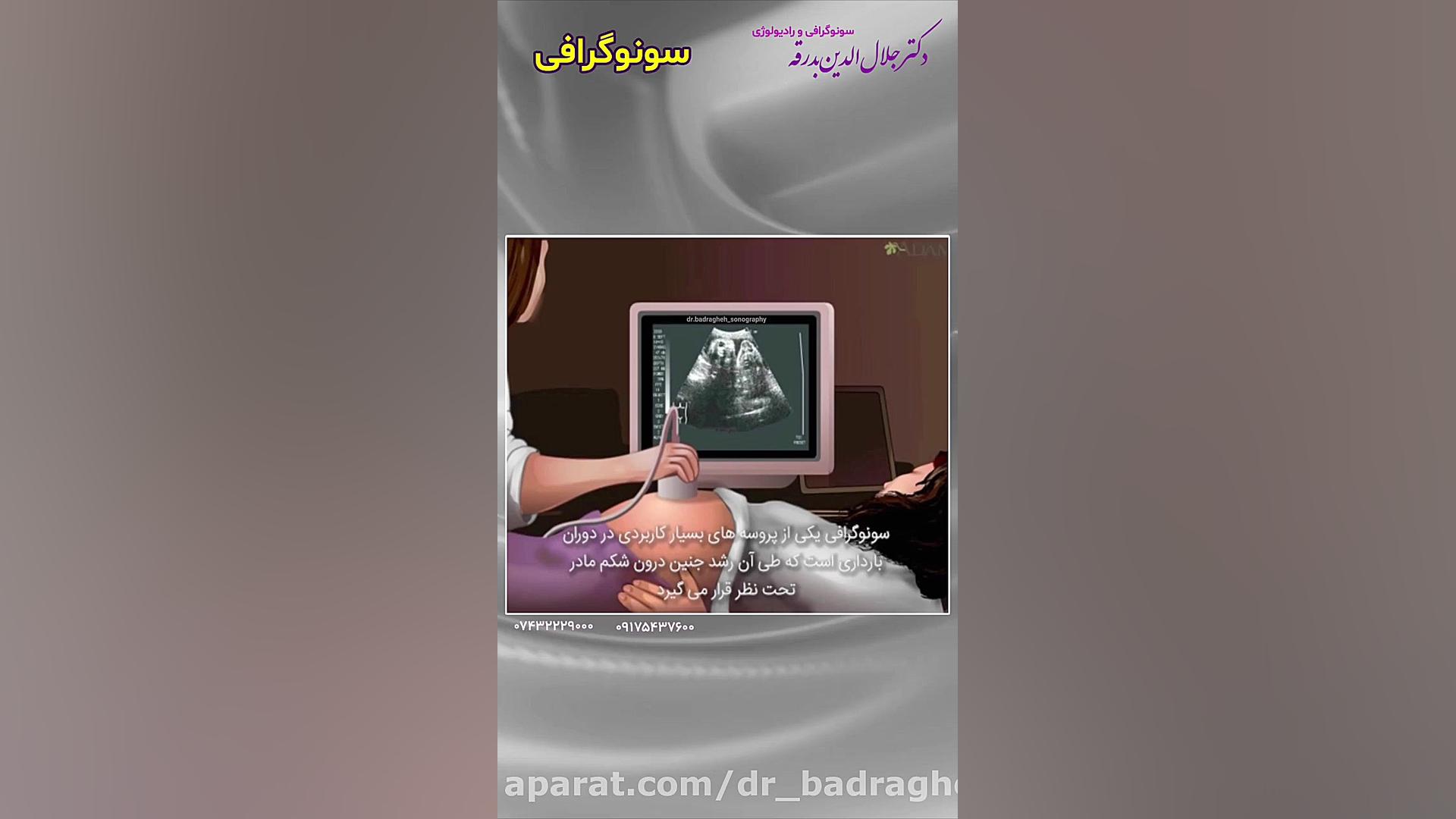 سونوگرافی دکتر جلال الدین بدرقه