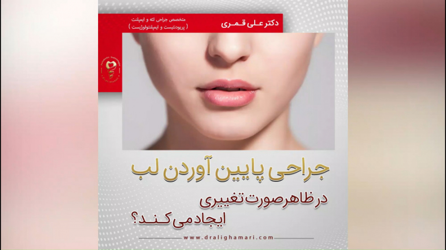 آیا جراحی پایین آوردن لب تاثیری در چهره دارد ؟ دکتر علی قمری - متخصص جراحی لثه و ایمپلنت