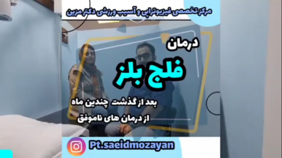 درمان فلج بلز کهنه تزریق بوتاکس