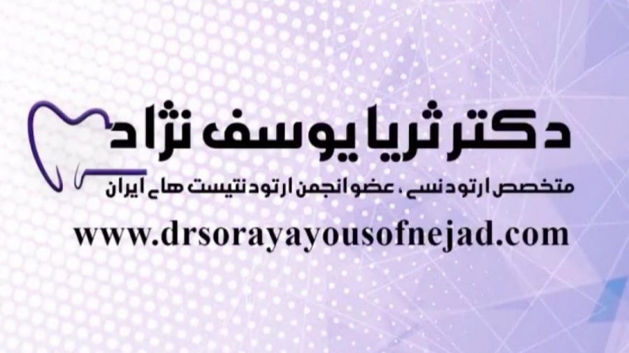 جایگزینی دندان های فک بالا دکتر ثریا یوسف نژاد متخصص ارتودنسی بابل