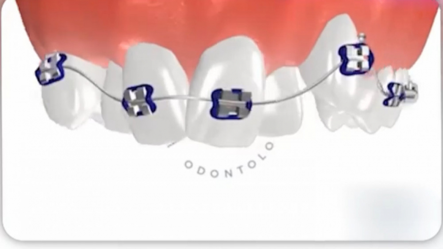 ارتودنسی دندان دکتر ثریا یوسف نژاد متخصص ارتودنسی بابل