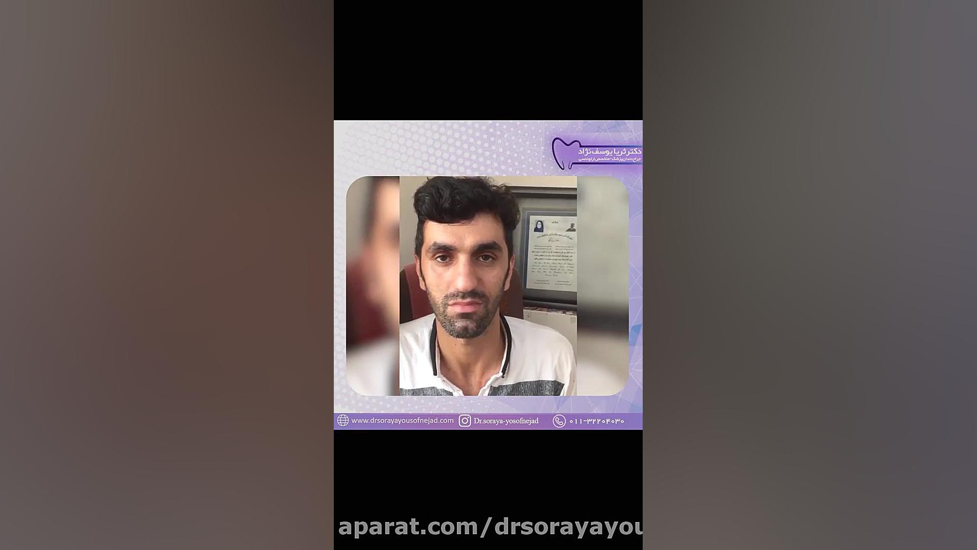 درمان ارتودنسی ثابت دو فک دکتر ثریا یوسف نژاد متخصص ارتودنسی بابل