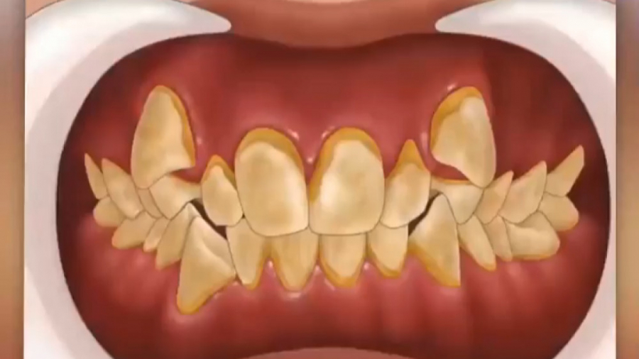 مراحل ارتودنسی دندان دکتر ثریا یوسف نژاد متخصص ارتودنسی بابل