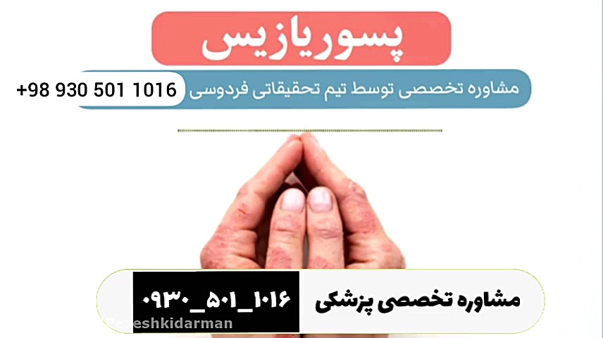 درمان پسوریازیس صدفک psoriasis پژوهشکده گیاهان دارویی جهاد دانشگاهی جنیفر لوپز