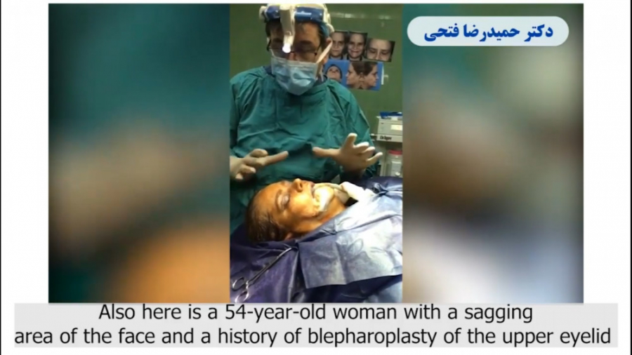 فیلم عمل لیفت صورت و جراحی پلک دکتر حمید رضا فتحی فوق تخصص جراحی پلاستیک