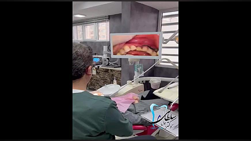 میکروسکوپ سه بعدی دندانپزشکی دکتر جمال سلطانی دندانپزشک خوب در تبریز