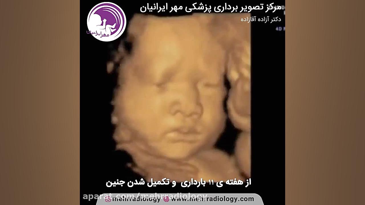 روند رشد و تکامل جنین پس از هفته یازدهم بارداری پلاستیک لثه