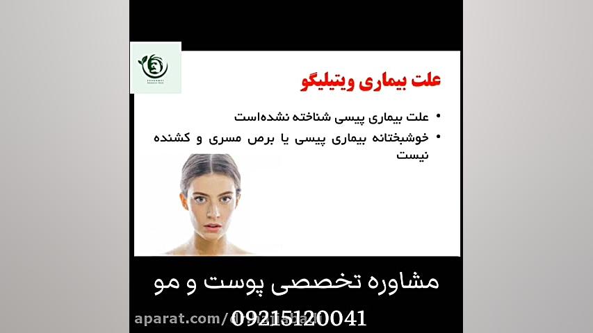 درمان قطعی برص یا ویتیلیگو ترند روز