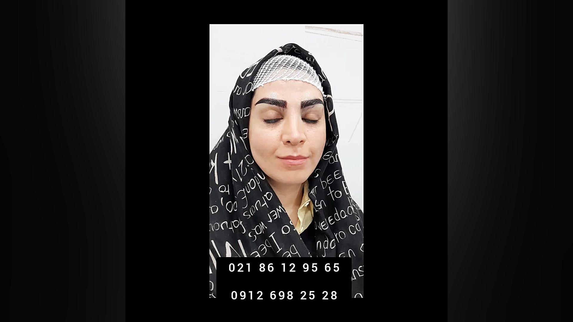 کاشت ابرو 31 ( مرکز تخصصی کاشت مو / ابرو لیان ) دستگاه بیوسنسور عرق
