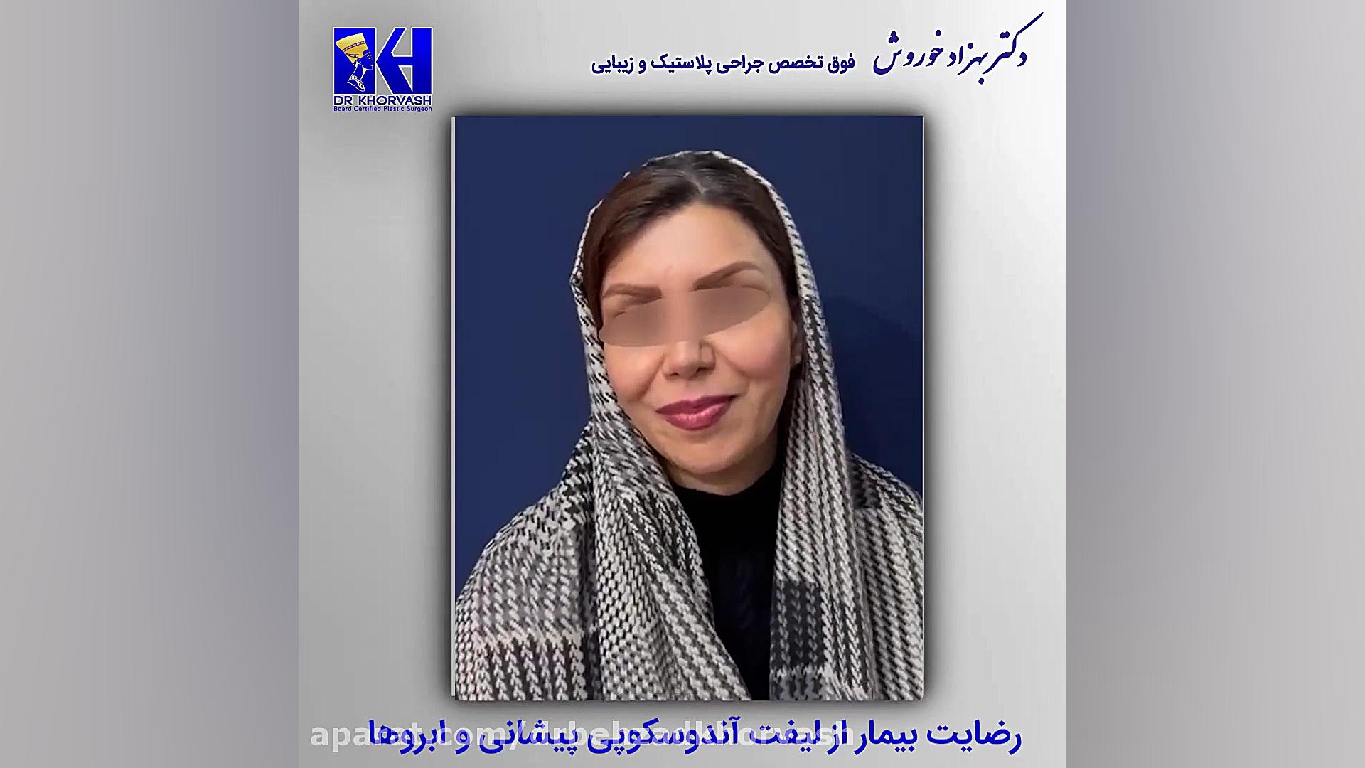 رضایت بیمار عزیز از لیفت آندوسکوپی پیشانی و ابروها | دکتر خوروش ویروس‌شناسی انسانی