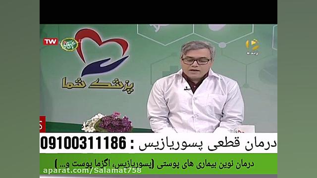 دارو های درمان قطعی بیماری های پسوریازیس صدف و برص گیمر