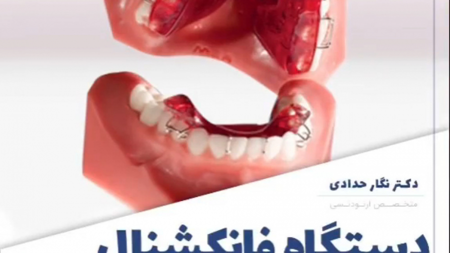 دستگاه فانکشنال تویین بلاک ارتودنسی چیه؟ | دکتر نگار حدادی کلینیک مو