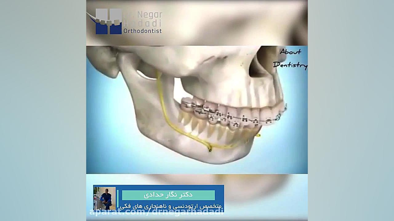 جراحی فک و درمان ارتودنسی | دکتر نگار حدادی بیماری آسپارتیل گلوکوزامینوریا