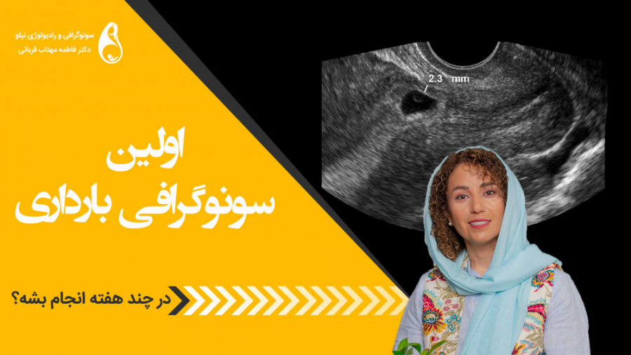 اولین سونوگرافی سونوگرافی نیلو دکتر فاطمه مهتاب قربانی