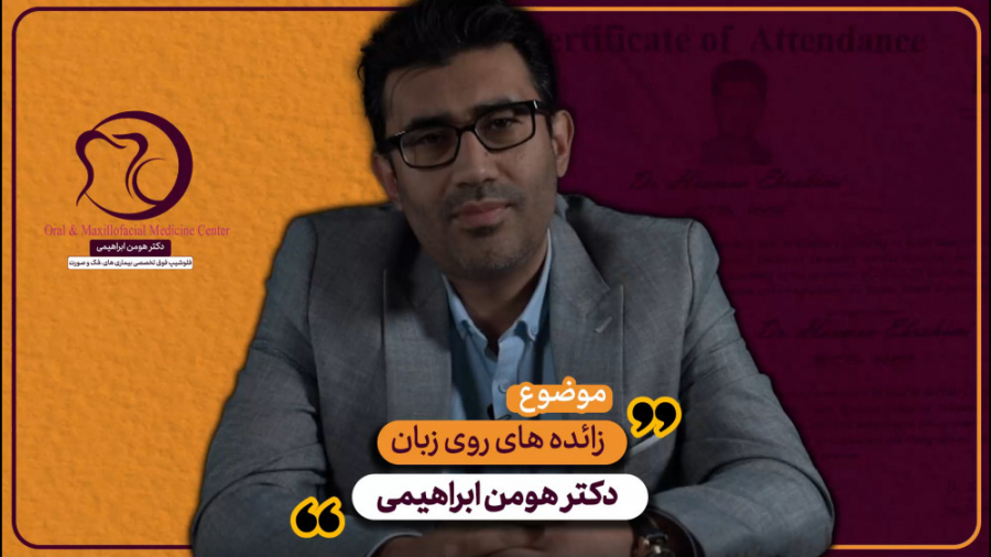 زائده های روی زبان -----> دکتر هومن ابراهیمی دکتر هومن ابراهیمی