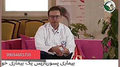پسوریازیس و درمان با دکتر خیراندیش استوری