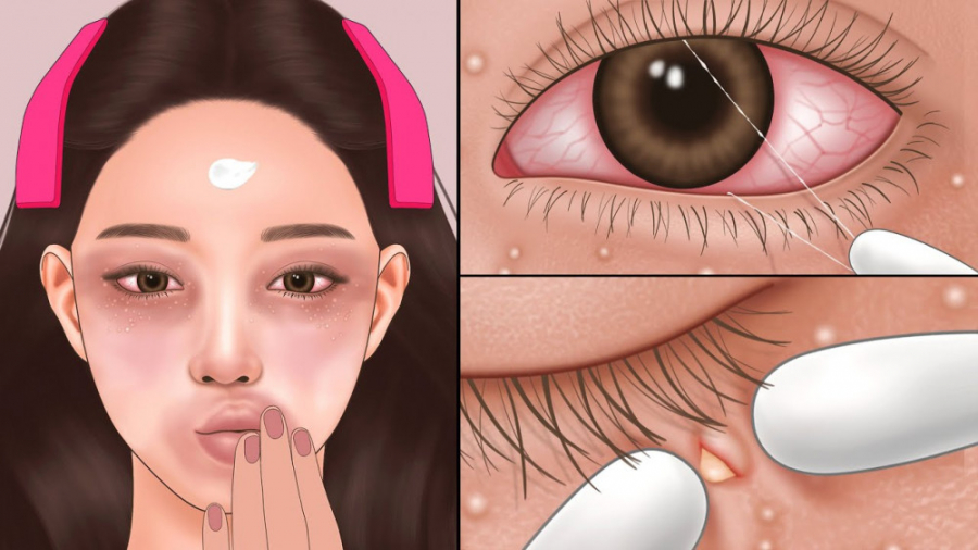 انیمیشن اسمر | پاکسازی پوست صورت اینسایزینگ