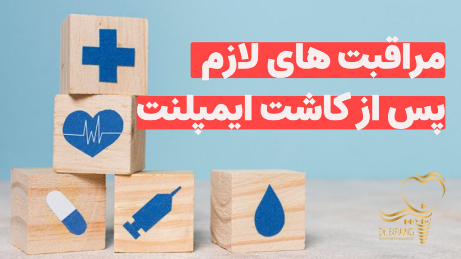 انیمیشنی کوتاه در خصوص مراقبت های بعد از ایمپلنت دکتر احسان بیرنگ