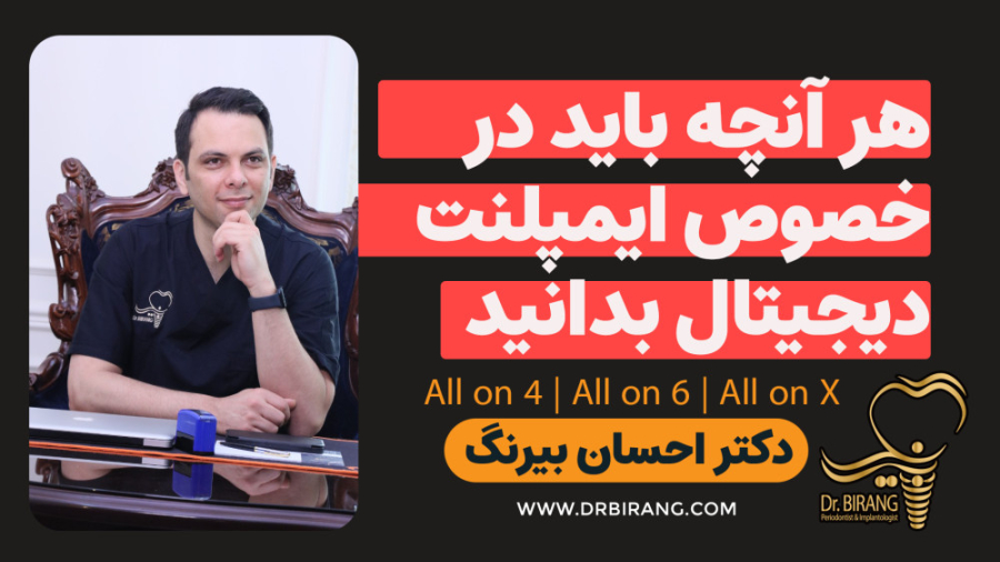هر آنچه که باید درباره ایمپلنت دیجیتال بدانید ! دکتر احسان بیرنگ