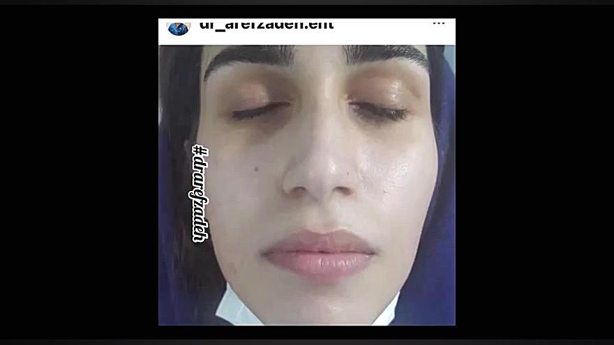 دکتراسماعیل عارف زاده، متخصص گوش، حلق،بینی ،جراح خر و پف ،مازندران اینسایزینگ