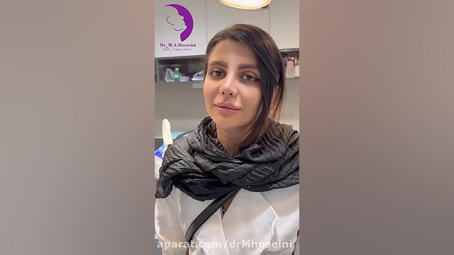 جراحی ترمیمی بینی بعد از باز کردن گچ بینی | دکتر محمدعلی حسینی مریل استریپ