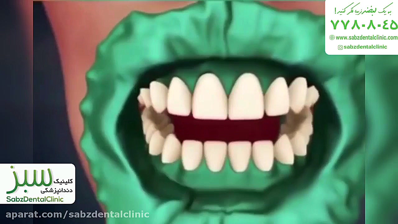 فیلم بلیچینگ دندان رادیوگرافی دندان