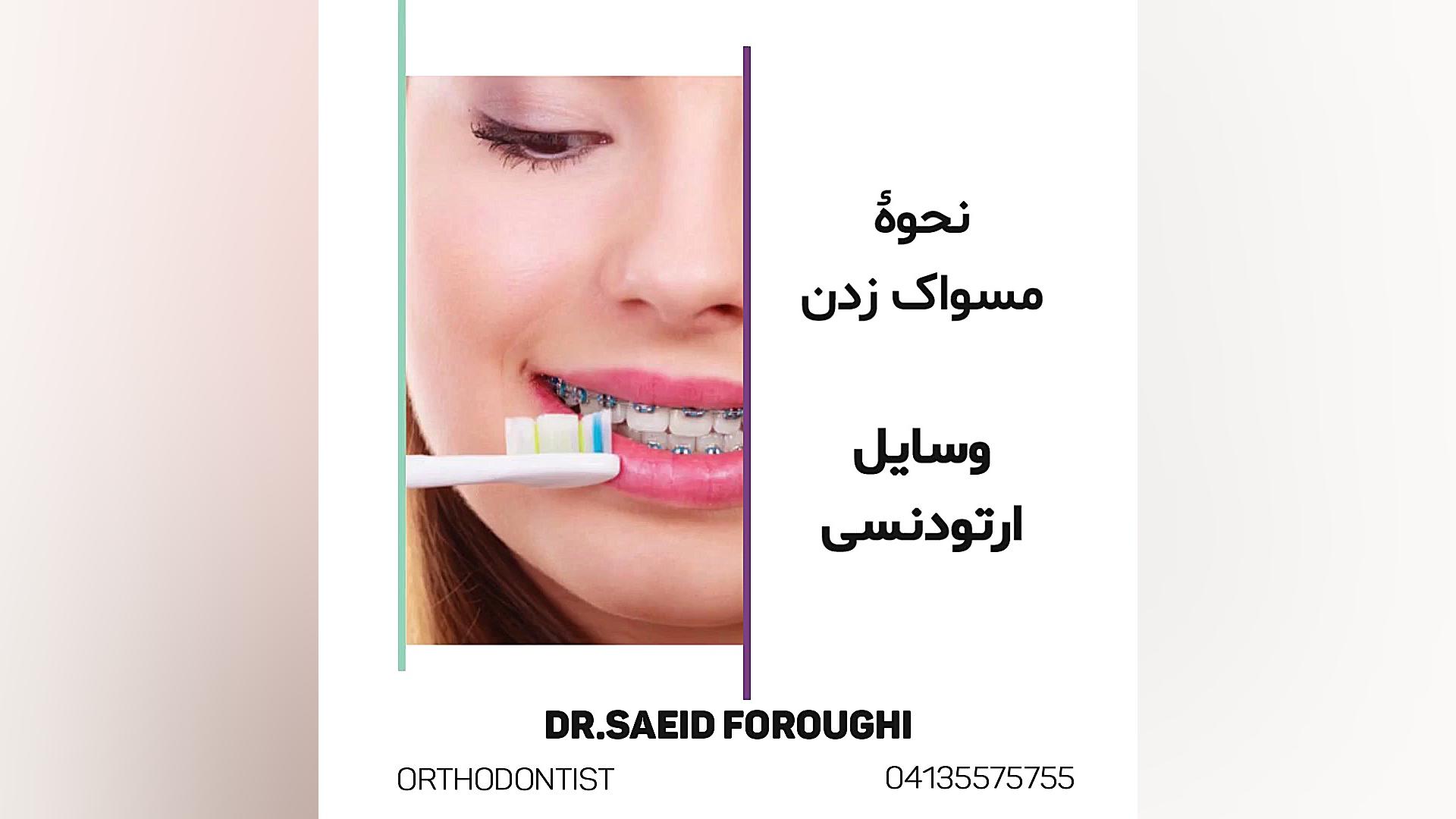 نحوه مسواک زدن وسایل ارتودنسی دکتر سعید فروغی متخصص ارتودنسی