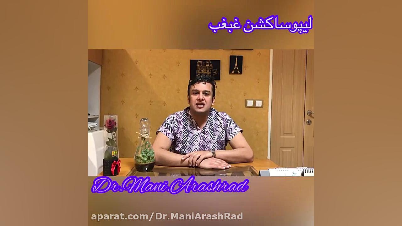 لیپوساکشن غبغب دکتر مانی آرش راد جراح فك و صورت
