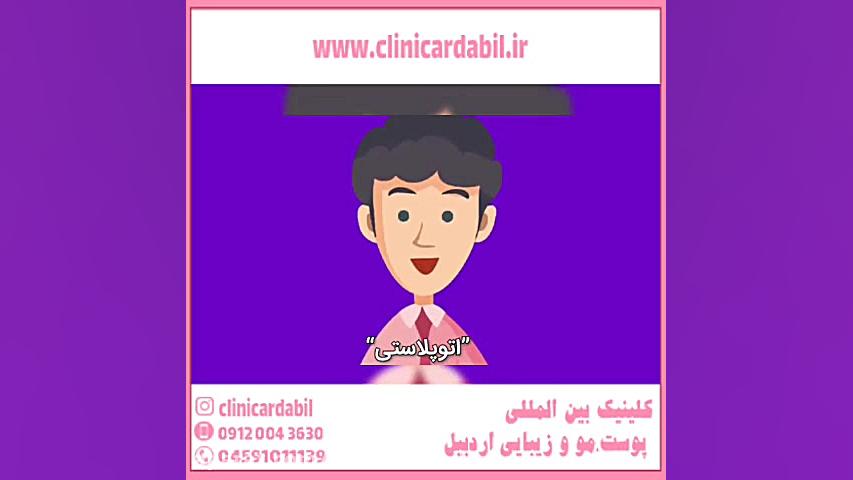 اتوپلاستی چیست و چگونه انجام می شود؟ SVR