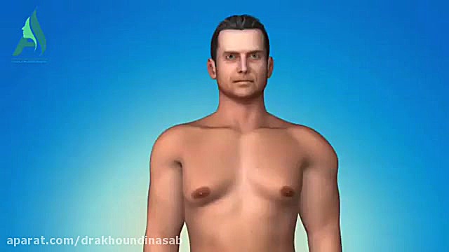 ژنیکوماستی چیست؟ دکتر محمدرضا آخوندی نسب-فوق تخصص جراحی پلاستیک