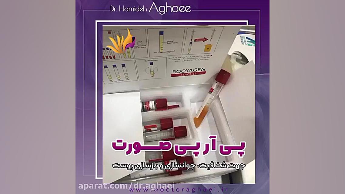 فیلم تزریق پی آر پی صورت دکتر حمیده آقایی