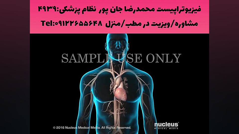 حادثه سکته قلبی با نمایشی دیدنی! حتماببینید/فیزیوتراپی۰۹۱۲۲۶۵۵۶۴۸نارمک،تهرانپارس جوانسازی پوست