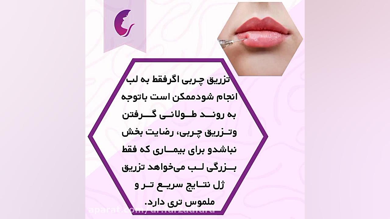 آیا می توان به لب ها چربی تزریق کرد؟ دکتر اسماعیل فرزاد فرد - فوق تخصص پلاستیک