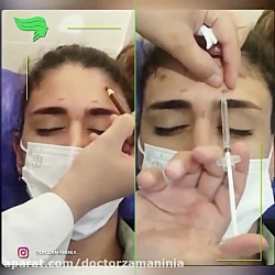 فیلم واقعی و بدون سانسور از تز...