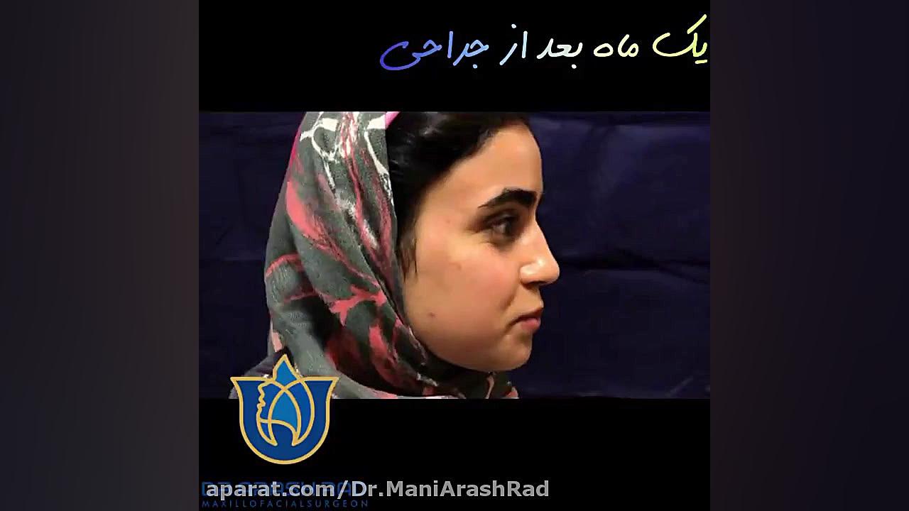 جراحی همزمان فک و چانه دکتر مانی آرش راد جراح فك و صورت